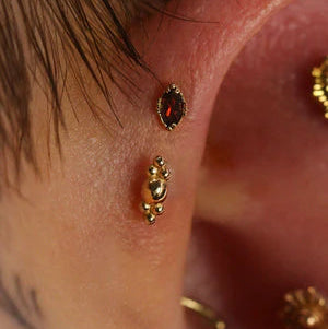 Gold Destin 2 End — Anatometal