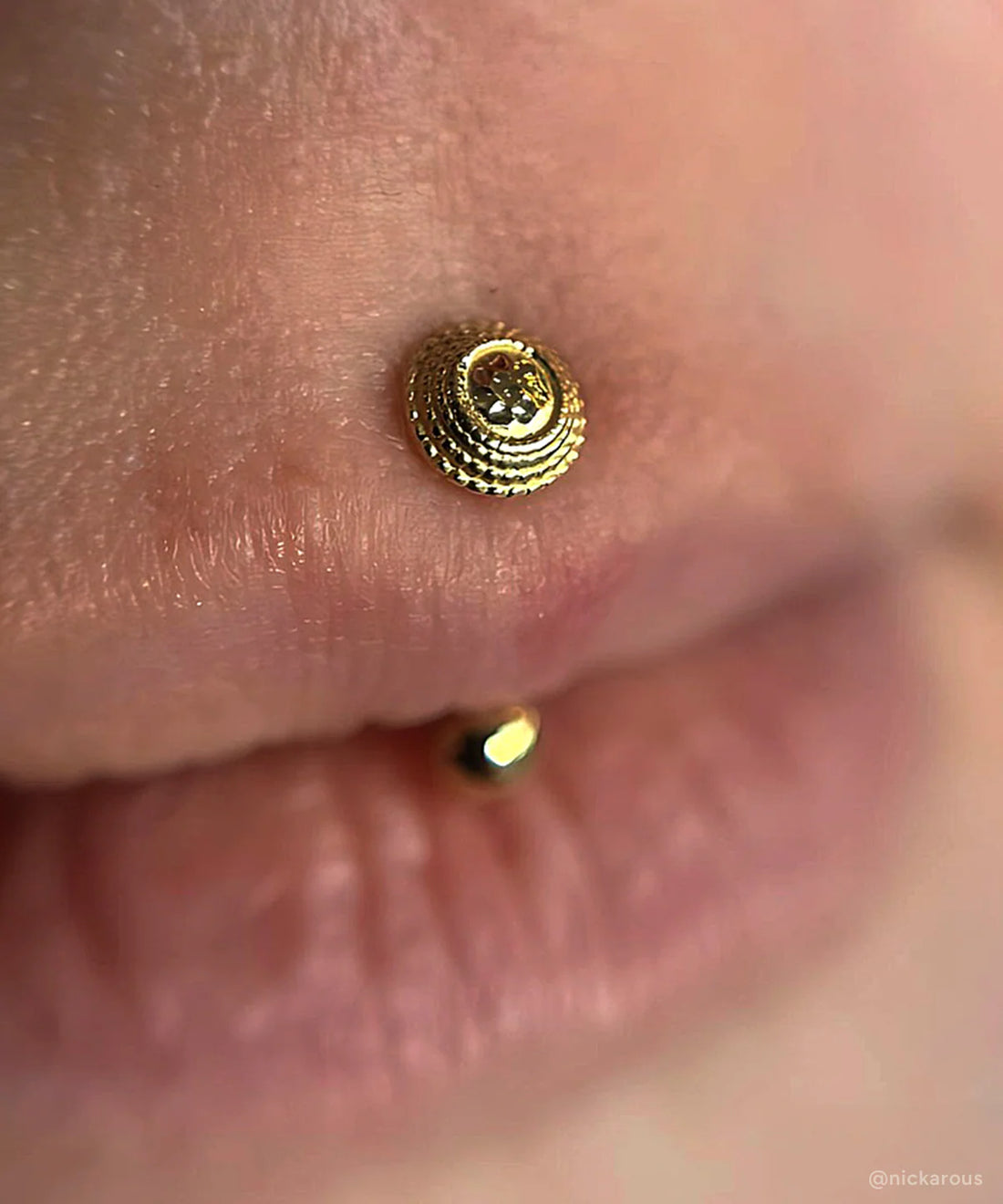 Gold Hara End — Anatometal