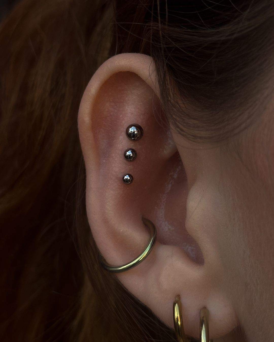 Titanium Domes
